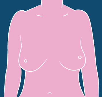 paso 1 autoexamen de seno