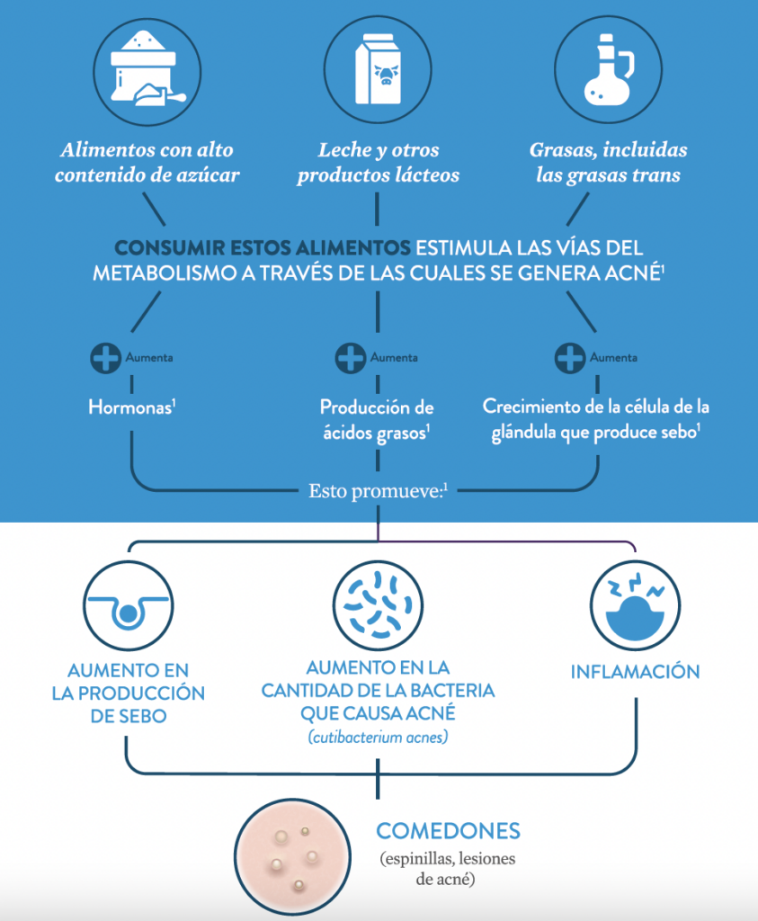 acné y dieta